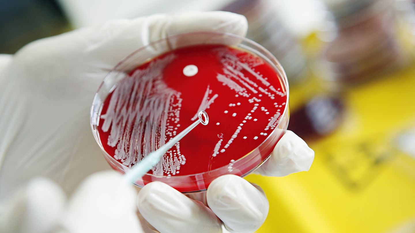 美国发现罕见致命细菌 可导致肺炎