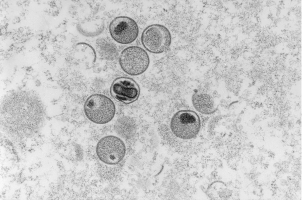 美国疾控中心官员反驳猴痘可以通过空气传播的说法