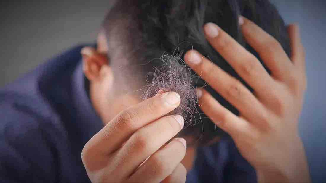 07/25 美国疫情更新：新冠后遗症可能导致脱发和男性功能障碍；拜登新冠症状几乎完全消失