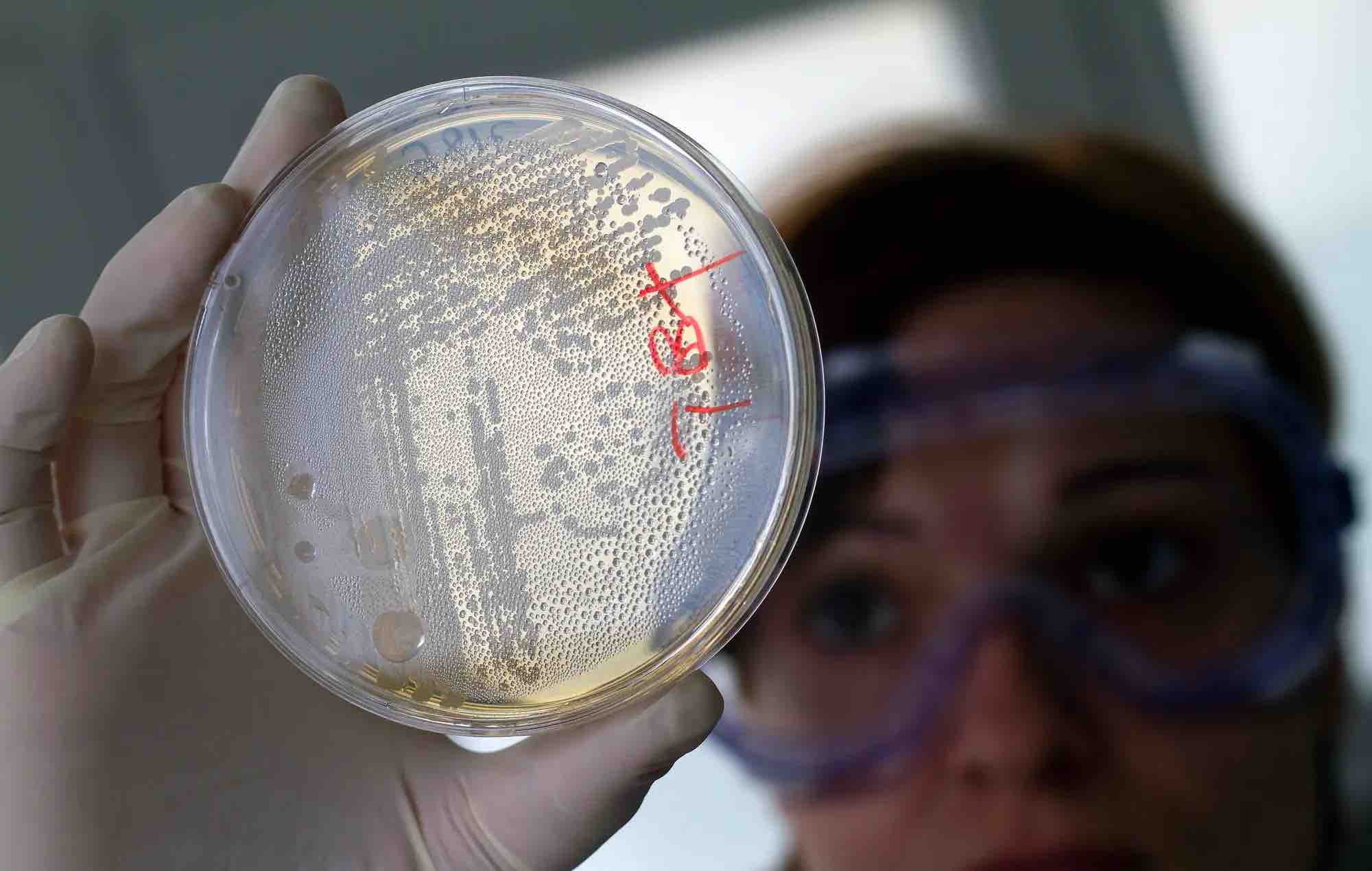美国惊现上百起大肠杆菌感染病例!