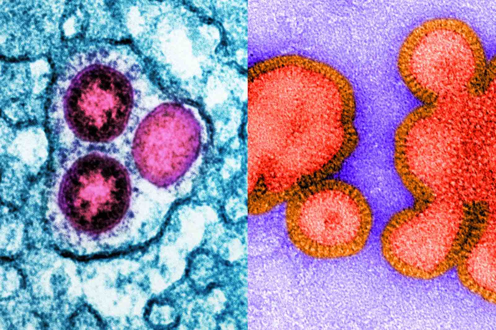 09/23 美国疫情更新：新冠“姐妹”病毒现世；流感新冠同时爆发引担忧 老人儿童需警惕